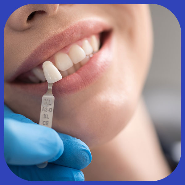 Implant-Dental-Treatment