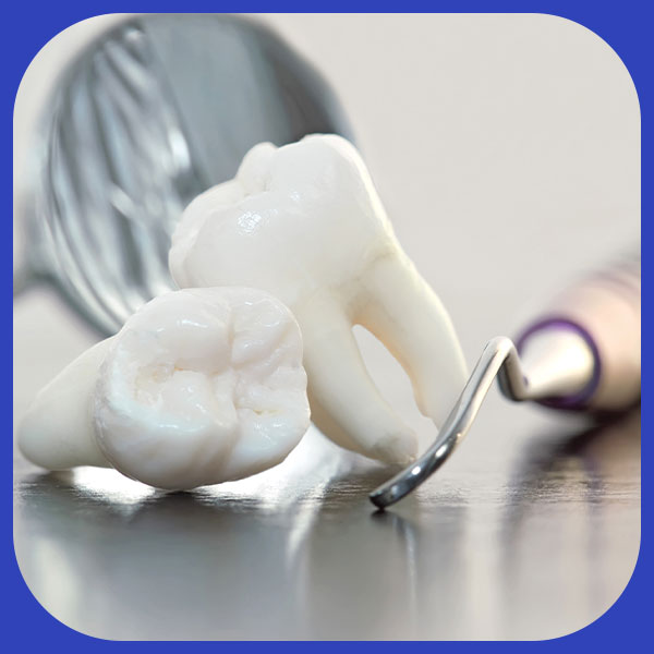 Simple-Tooth-Extraction
