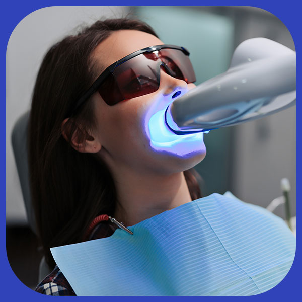 Teeth-Whitening
